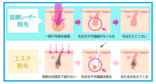 イメージ図