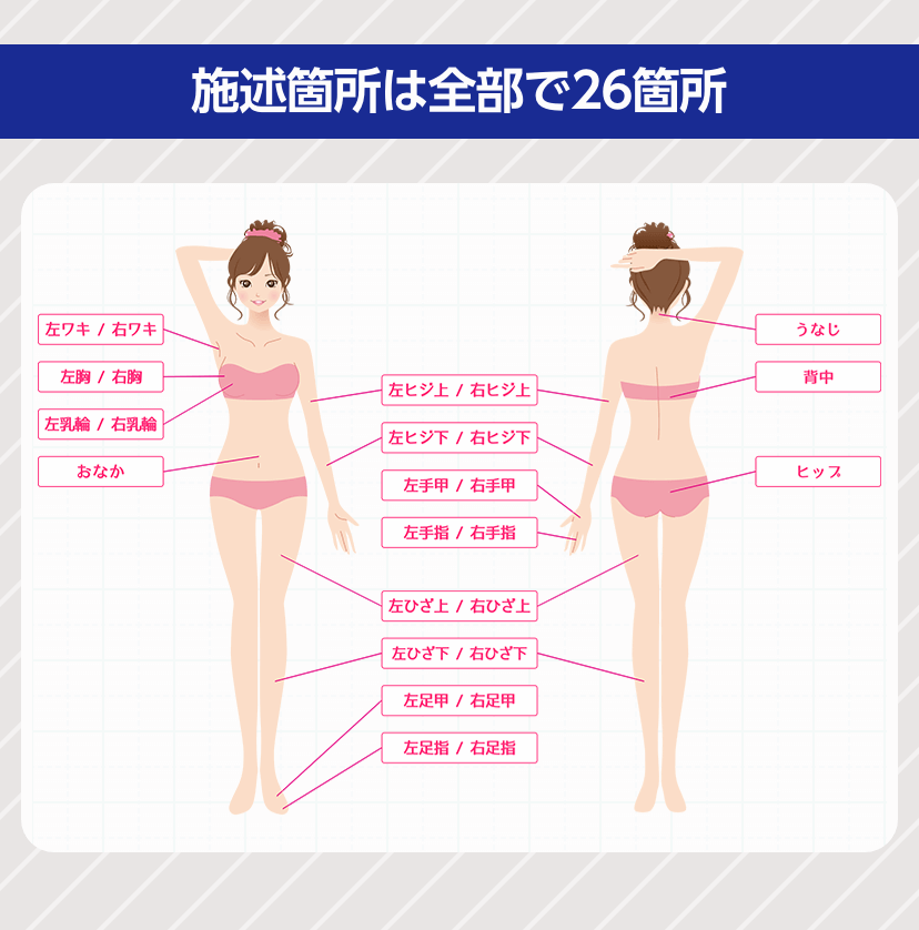 全身26ヶ所